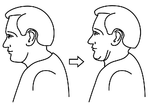 chin tuck shoulder pain